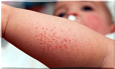 Watch out for those little pimples and skin irritations