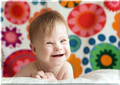 Babies with Down syndrome and breastfeeding